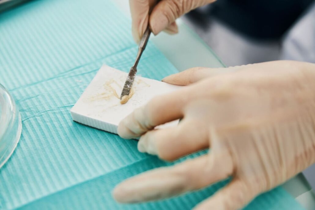 Amestecul de ciment dentar se transformă în material solid sub mișcarea spatulei.