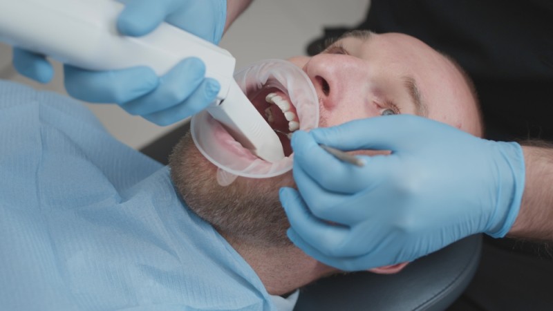 Imagine cu o scanare intraorala pentru amprenta dentara