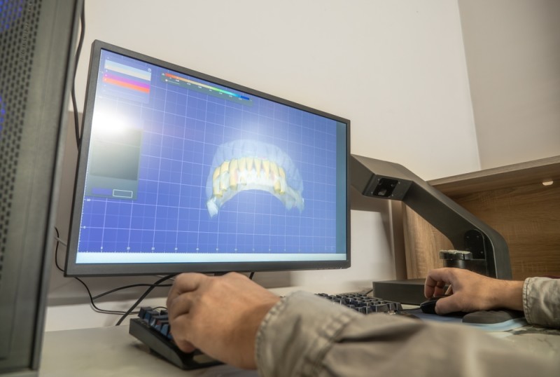 Simulare digitală a lucrărilor dentare